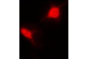 Immunofluorescent analysis of Sm-D2 staining in MCF7 cells. (SNRPD2 抗体)