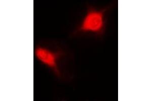 Immunofluorescent analysis of Sm-D2 staining in MCF7 cells. (SNRPD2 抗体)