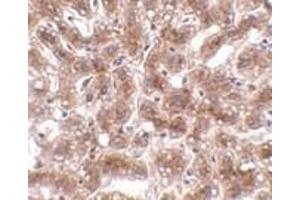 Immunohistochemistry of CUEDC1 in human liver tissue with CUEDC1 antibody at 2 μg/ml. (CUEDC1 抗体  (C-Term))