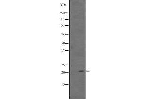 Western blot analysis of ARL11 expression in Human kidney tissue lysate ,The lane on the left is treated with the antigen-specific peptide. (ARL11 抗体  (Internal Region))