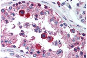 Human Testis (formalin-fixed, paraffin-embedded) stained with HAVCR1 antibody ABIN292373 at 5 ug/ml followed by biotinylated goat anti-rabbit IgG secondary antibody ABIN481713, alkaline phosphatase-streptavidin and chromogen. (HAVCR1 抗体  (N-Term))