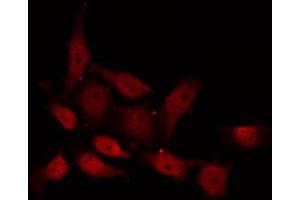 ABIN6267617 staining NIH-3T3 by IF/ICC. (PKC delta 抗体  (pSer645))