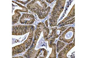 IHC analysis of SNRPN using anti-SNRPN antibody (ABIN3043934).