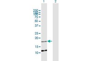 Western Blot analysis of C2orf28 expression in transfected 293T cell line by C2orf28 MaxPab polyclonal antibody. (ATRAID 抗体  (AA 1-171))