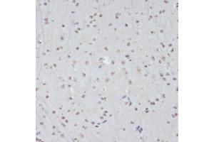 Immunohistochemistry of paraffin-embedded mouse brain using Phospho-CDK1-Y15 antibody (ABIN3019442, ABIN3019443, ABIN3019444 and ABIN6225371) at dilution of 1:100 (40x lens). (CDK1 抗体  (pTyr15))