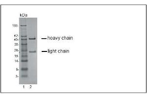 SDS-PAGE analysis of purified KH-4F5 monoclonal antibody. (CCR4 抗体)