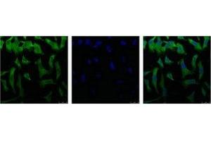 IF analysis of Hela with antibody (Left) and DAPI (Right) diluted at 1:100. (EIF4A1 抗体)