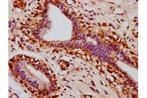 Immunohistochemistry (IHC) image for anti-Signal Transducer and Activator of Transcription 3 (Acute-Phase Response Factor) (STAT3) (pSer727) antibody (ABIN7127754)