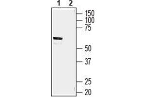 Western Blotting (WB) image for anti-Solute Carrier Family 2 (Facilitated Glucose/fructose Transporter), Member 5 (SLC2A5) (AA 477-490), (Intracellular) antibody (ABIN7043702)