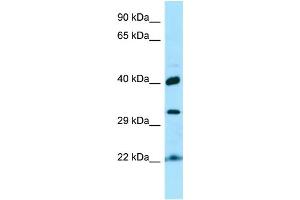 WB Suggested Anti-KTI12 Antibody Titration: 1. (KTI12 抗体  (C-Term))