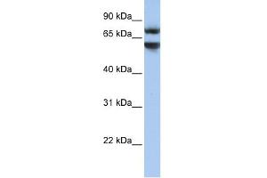 WB Suggested Anti-JPH3 Antibody Titration:  0. (Junctophilin 3 抗体  (N-Term))