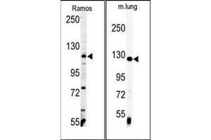 (LEFT) Western blot analysis of anti-VINC Antibody (C-term) in Ramos cell line lysates (35ug/lane). (Vinculin 抗体  (C-Term))