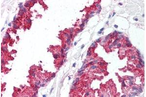 Human Prostate (formalin-fixed, paraffin-embedded) stained with BACE1 antibody ABIN213581 at 5 ug/ml followed by biotinylated goat anti-rabbit IgG secondary antibody ABIN481713, alkaline phosphatase-streptavidin and chromogen. (BACE1 抗体  (C-Term))
