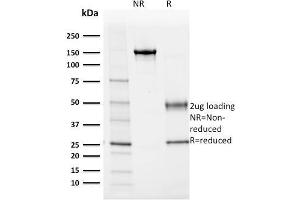 SDS-PAGE (SDS) image for anti-Albumin (ALB) antibody (ABIN6939358)