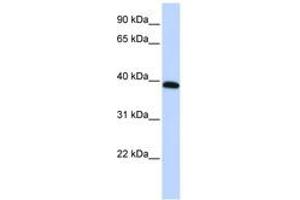 Image no. 1 for anti-Homeobox A10 (HOXA10) (AA 288-337) antibody (ABIN6744392) (HOXA10 抗体  (AA 288-337))