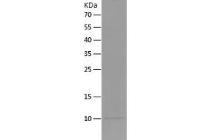 Insulin-Like Growth Factor 1 (IGF1) (AA 49-118) protein (His tag)