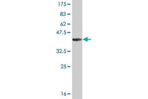 Western Blot detection against Immunogen (36. (KAT2B 抗体  (AA 353-452))
