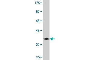 Western Blot detection against Immunogen (36. (EXOSC4 抗体  (AA 1-100))