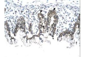 Image no. 1 for anti-Prohibitin (PHB) (AA 203-252) antibody (ABIN6735810)