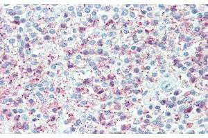Detection of TNFaIP6 in Human Spleen Tissue using Polyclonal Antibody to Tumor Necrosis Factor Alpha Induced Protein 6 (TNFaIP6) (TNFAIP6 抗体  (AA 18-275))