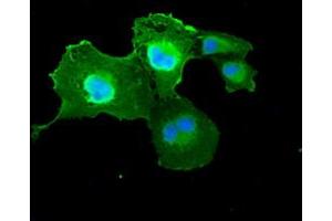 Anti-DFFA mouse monoclonal antibody (ABIN2452370) immunofluorescent staining of COS7 cells transiently transfected by pCMV6-ENTRY DFFA (RC202879). (DFFA 抗体)