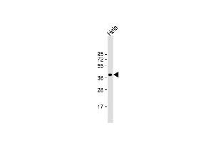 Anti-ARPC1B Antibody (Center) at 1:1000 dilution + Hela whole cell lysate Lysates/proteins at 20 μg per lane. (ARPC1B 抗体  (AA 159-188))