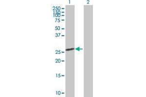 Western Blotting (WB) image for anti-Secretagogin, EF-Hand Calcium Binding Protein (SCGN) (AA 1-276) antibody (ABIN524016)