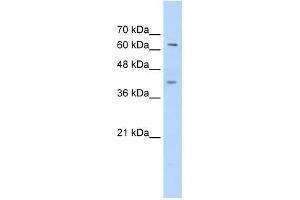 Western Blot showing ZNF415 antibody used at a concentration of 1-2 ug/ml to detect its target protein. (ZNF415 抗体  (C-Term))