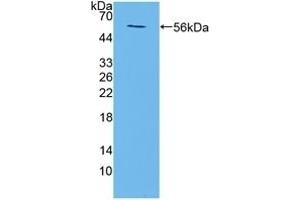 Detection of Recombinant TMEM27, Mouse using Polyclonal Antibody to Transmembrane Protein 27 (TMEM27) (TMEM27 抗体  (AA 12-222))