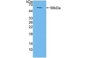 Detection of Recombinant TMEM27, Mouse using Polyclonal Antibody to Transmembrane Protein 27 (TMEM27) (TMEM27 抗体  (AA 12-222))