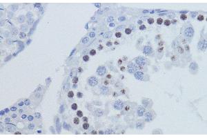 Immunohistochemistry of paraffin-embedded Rat testis using DiMethyl-Histone H3-K9 Polyclonal Antibody at dilution of 1:200 (40x lens).