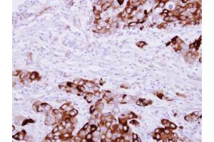 Immunohistochemistry (IHC) image for anti-Fibrinogen gamma Chain (FGG) antibody (ABIN2856626)