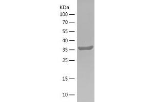 Western Blotting (WB) image for Protein-tyrosine Phosphatase 1C (PTPN6) (AA 5-163) protein (His-IF2DI Tag) (ABIN7124693)