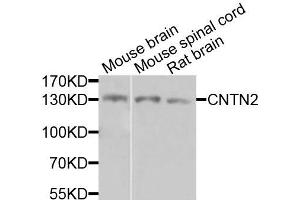 Western blot analysis of extracts of various cells, using CNTN2 antibody. (CNTN2 抗体)