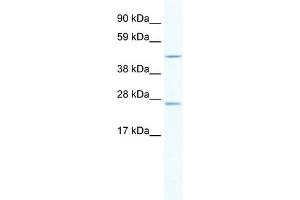 WB Suggested Anti-ANXA11 Antibody Titration:  2. (Annexin A11 抗体  (C-Term))