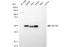 Western blotting analysis using EEF1A2 antibody (ABIN7798499). (Recombinant EEF1A2 抗体)