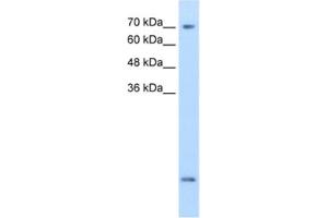 Western Blotting (WB) image for anti-Solute Carrier Family 6 (Neurotransmitter Transporter, Creatine), Member 8 (SLC6A8) antibody (ABIN2462555) (SLC6A8 抗体)