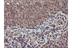 Image no. 4 for anti-V-Akt Murine Thymoma Viral Oncogene Homolog 1 (AKT1) antibody (ABIN1496554) (AKT1 抗体)