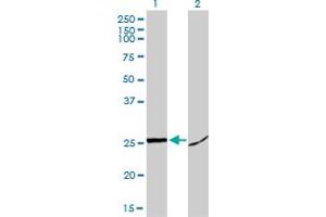 Western Blot analysis of HMGB1 expression in transfected 293T cell line by HMGB1 monoclonal antibody (M02), clone 1D5.