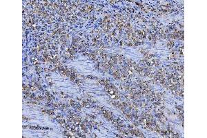 IHC analysis of Asparagine synthetase/ASNS using anti-Asparagine synthetase/ASNS antibody (ABIN7599465).