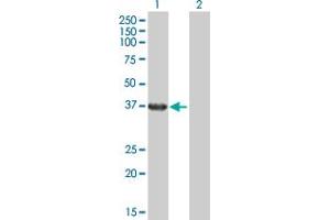 Western Blot analysis of RHOXF2 expression in transfected 293T cell line by RHOXF2 MaxPab polyclonal antibody. (RHOXF2 抗体  (AA 1-288))
