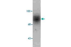 Western blot of human caudate lysate showing specific immunolabeling of the ~88k SLC6A3 protein. (SLC6A3 抗体  (C-Term))