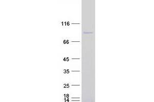 Western Blotting (WB) image for Aprataxin and PNKP Like Factor (APLF) protein (Myc-DYKDDDDK Tag) (ABIN2714804)