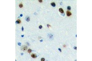Immunohistochemistry (IHC) image for anti-Zinc Finger CCCH-Type Containing 7B (ZC3H7B) (C-Term) antibody (ABIN7303122)