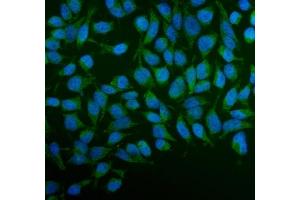 IF analysis of PFKFB2 using anti-PFKFB2 antibody (ABIN7601627). (PFKFB2 抗体  (AA 4-505))