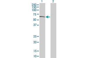 Western Blot analysis of DYRK2 expression in transfected 293T cell line by DYRK2 monoclonal antibody (M02), clone 6E2. (DYRK2 抗体  (AA 1-100))