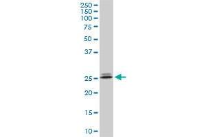 PHOSPHO1 monoclonal antibody (M10), clone 1A11. (PHOSPHO1 抗体  (AA 168-266))