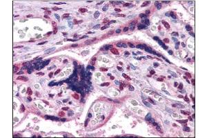 Immunohistochemistry Image: Human Placenta: Formalin-Fixed, Paraffin-Embedded (FFPE) (GBX2 抗体  (Internal Region))