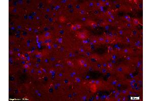 Formalin-fixed and paraffin embedded: rat brain tissue labeled with Anti-ARC Polyclonal Antibody (ABIN739460), Unconjugated at 1:200, followed by conjugation to the secondary antibody was Goat Anti-Rabbit IgG, PE conjugated at 1:200 for 40 minutes at 37°C DAPI(5 µg/ml, blue) was used to stain the cell nuclei (Arc 抗体  (AA 101-200))