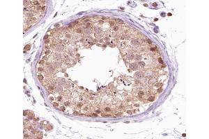 ABIN6266538 at 1/100 staining human testis tissue sections by IHC-P. (FGFR1OP 抗体  (C-Term))